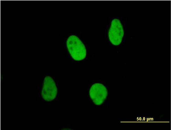 XRCC6 Antibody in Immunocytochemistry (ICC/IF)