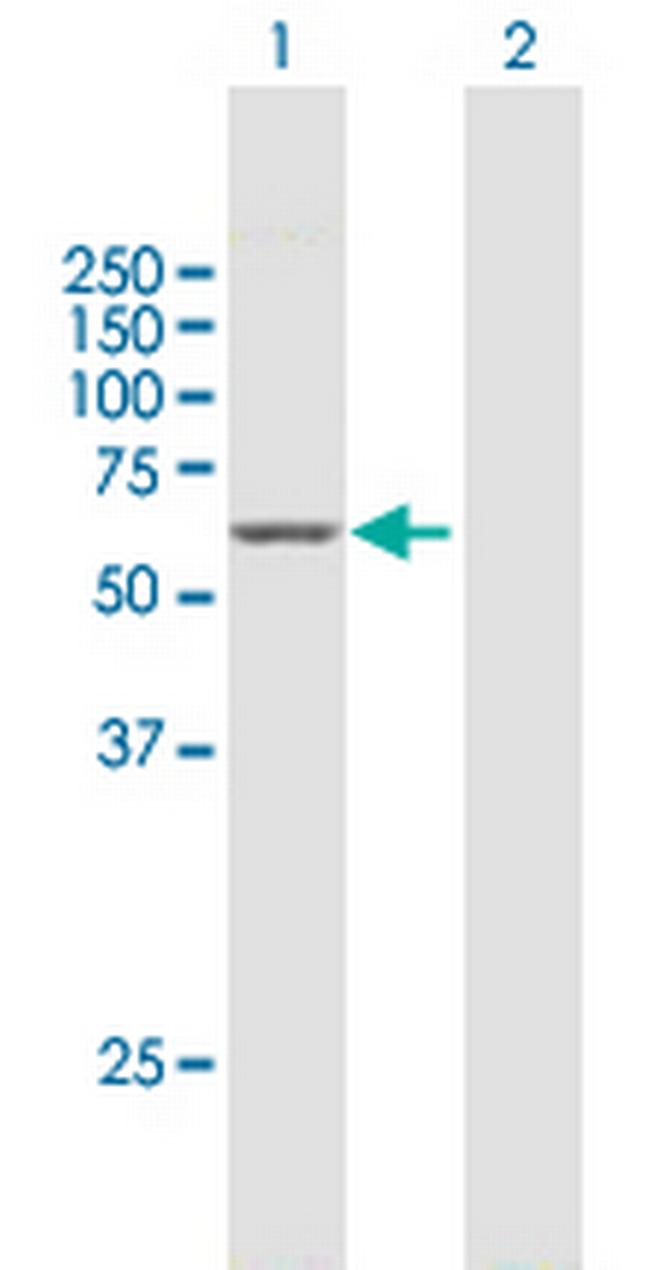 GAD2 Antibody in Western Blot (WB)