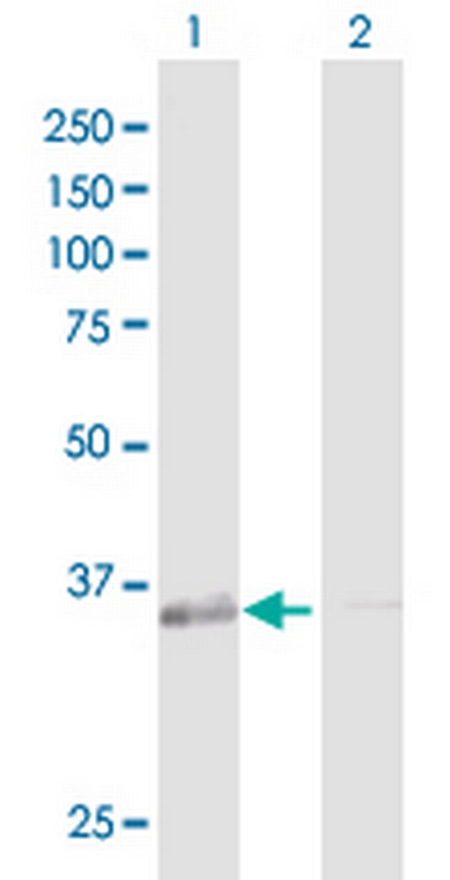 GALE Antibody in Western Blot (WB)