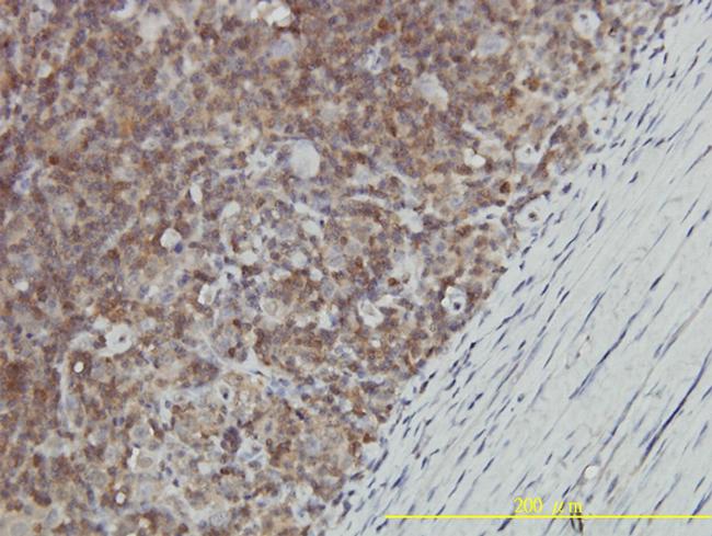 GALT Antibody in Immunohistochemistry (Paraffin) (IHC (P))