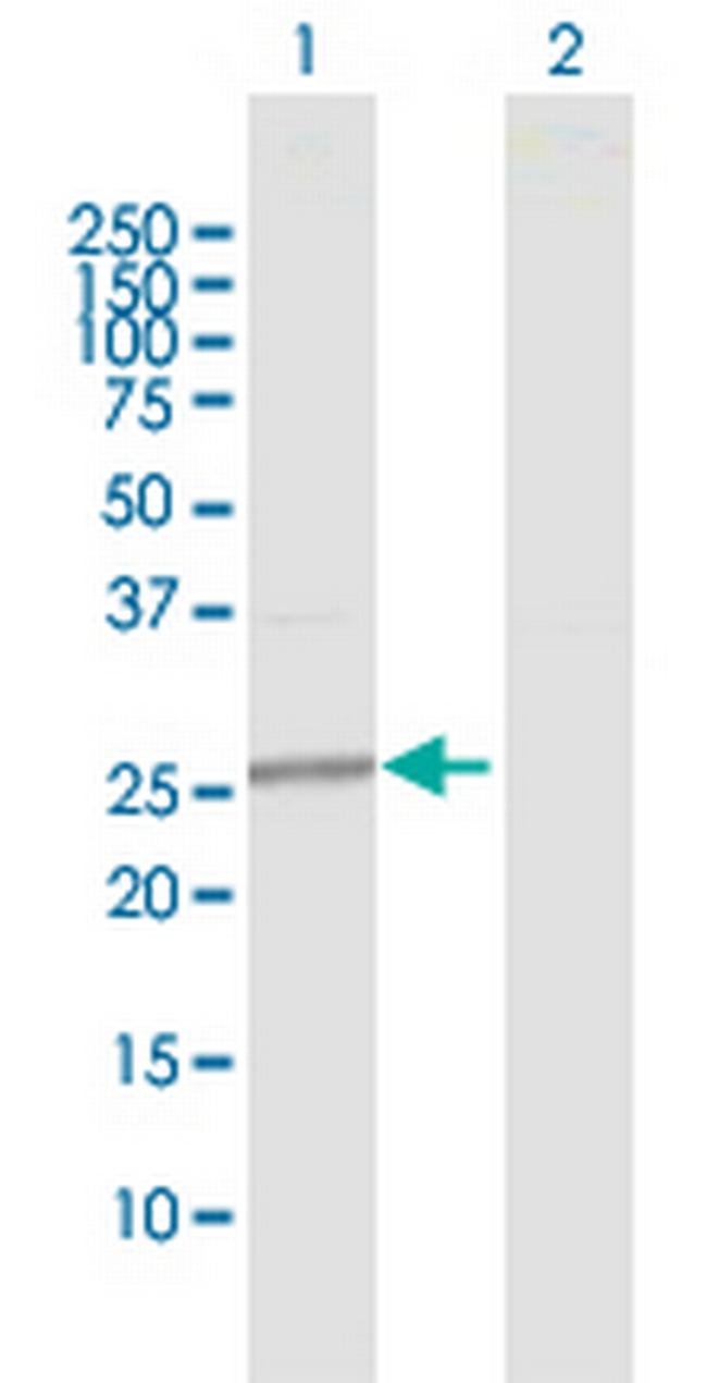 GAMT Antibody in Western Blot (WB)