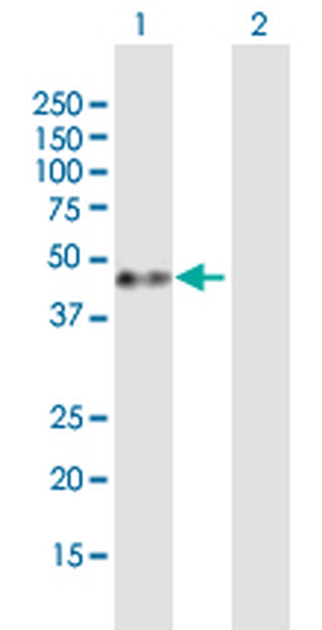 GAP43 Antibody in Western Blot (WB)