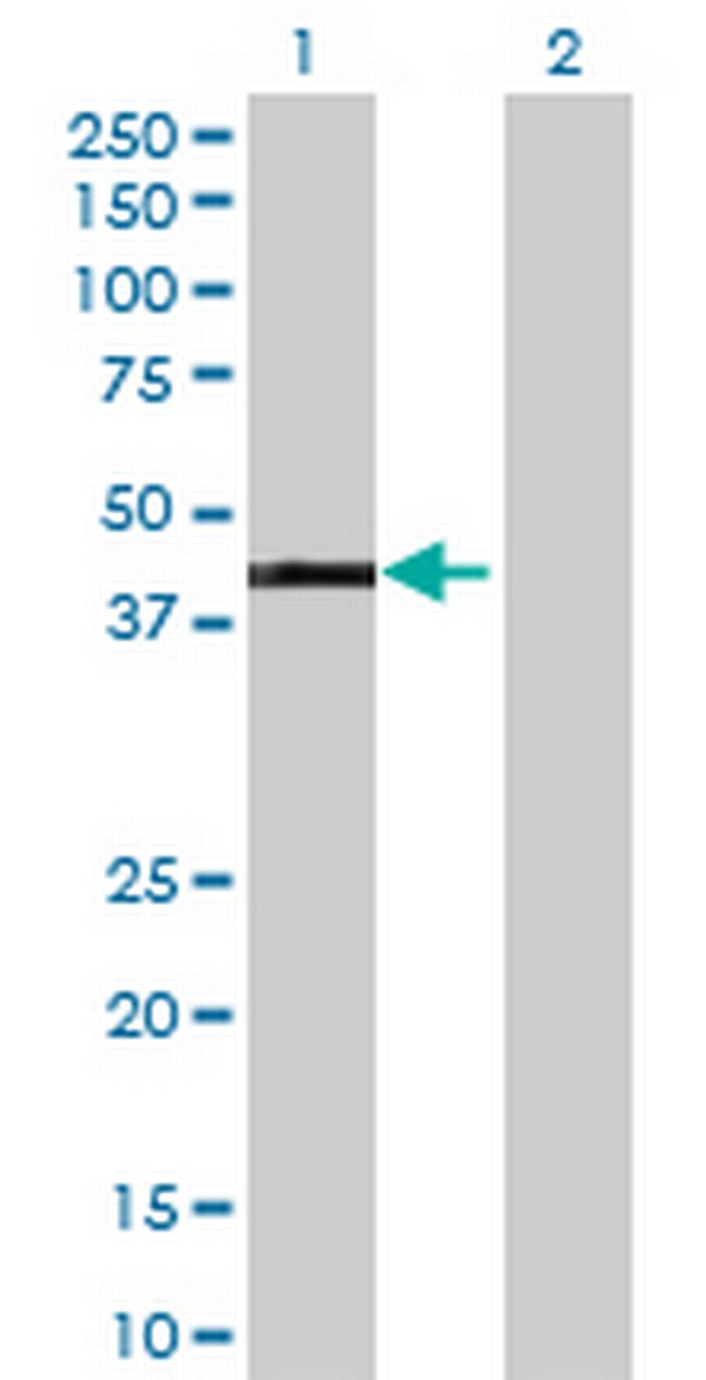 GATA1 Antibody in Western Blot (WB)