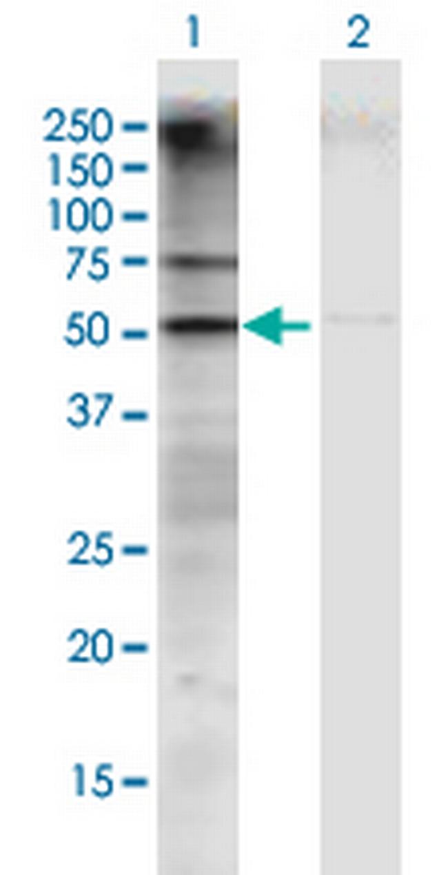 GATM Antibody in Western Blot (WB)