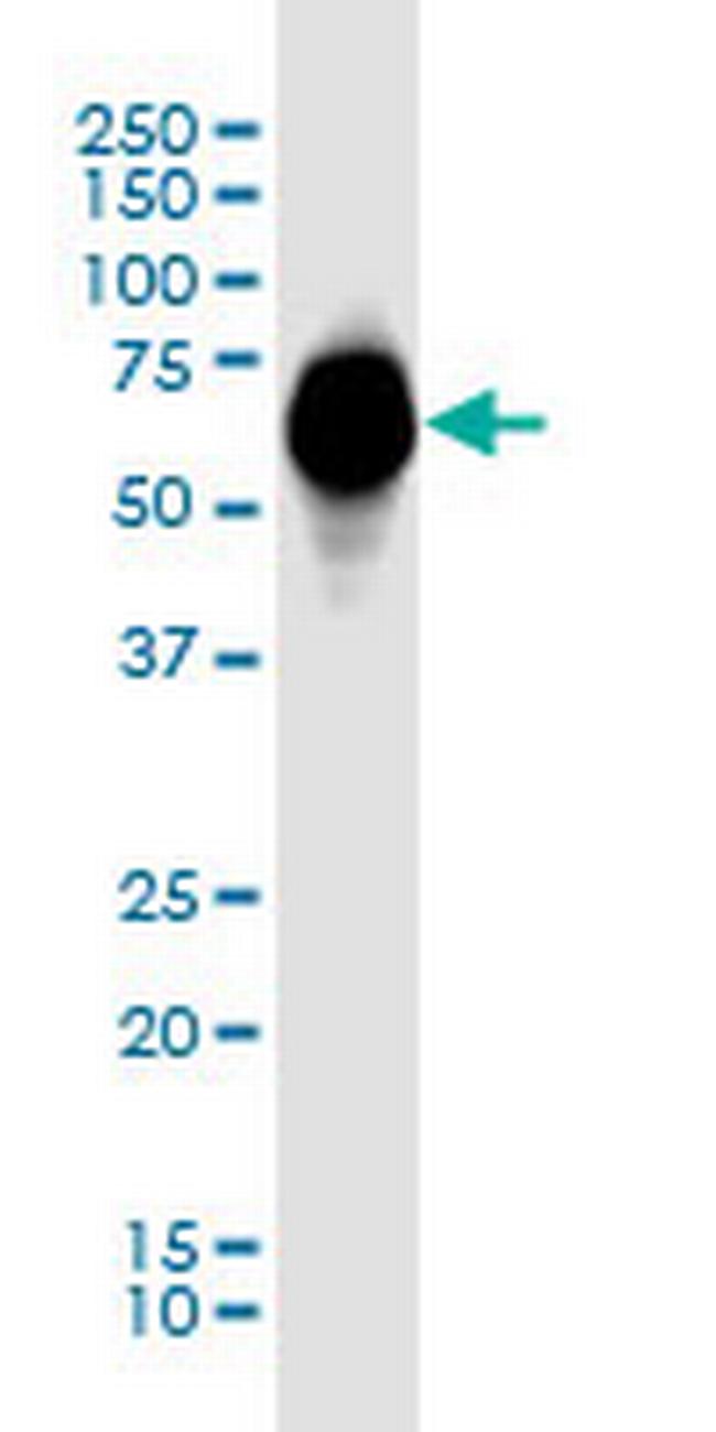 GBA Antibody in Western Blot (WB)