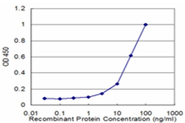 GBA Antibody in ELISA (ELISA)