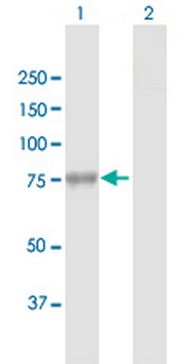 GBE1 Antibody in Western Blot (WB)