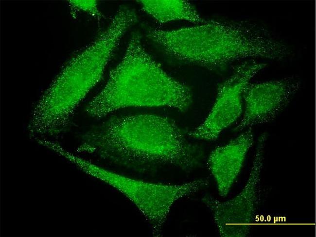 GCH1 Antibody in Immunocytochemistry (ICC/IF)