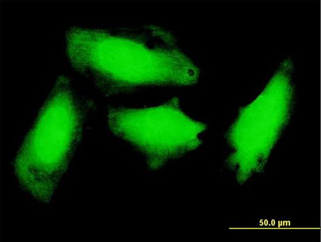 GCH1 Antibody in Immunocytochemistry (ICC/IF)