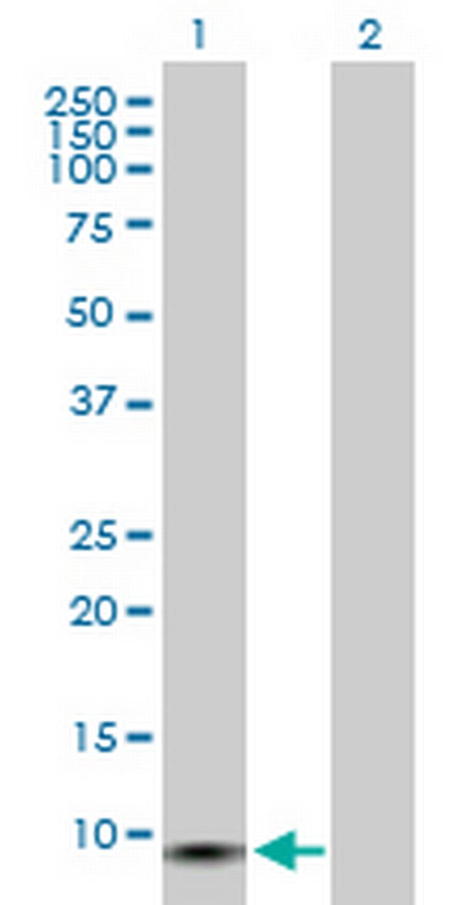 GCHFR Antibody in Western Blot (WB)