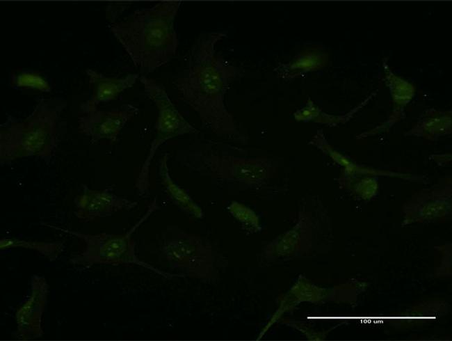 GCHFR Antibody in Immunocytochemistry (ICC/IF)