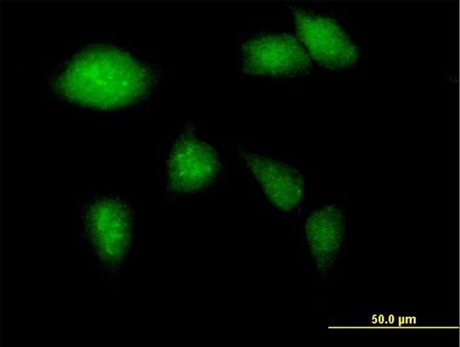 GCK Antibody in Immunocytochemistry (ICC/IF)