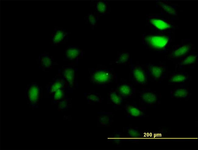 GCN5L2 Antibody in Immunocytochemistry (ICC/IF)