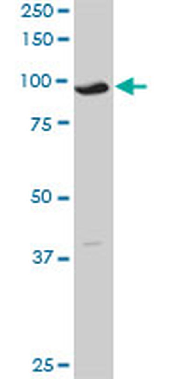 GCN5L2 Antibody in Western Blot (WB)