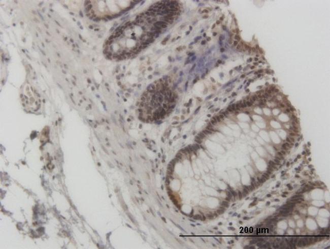 GCN5L2 Antibody in Immunohistochemistry (Paraffin) (IHC (P))