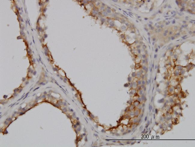 GGT1 Antibody in Immunohistochemistry (Paraffin) (IHC (P))