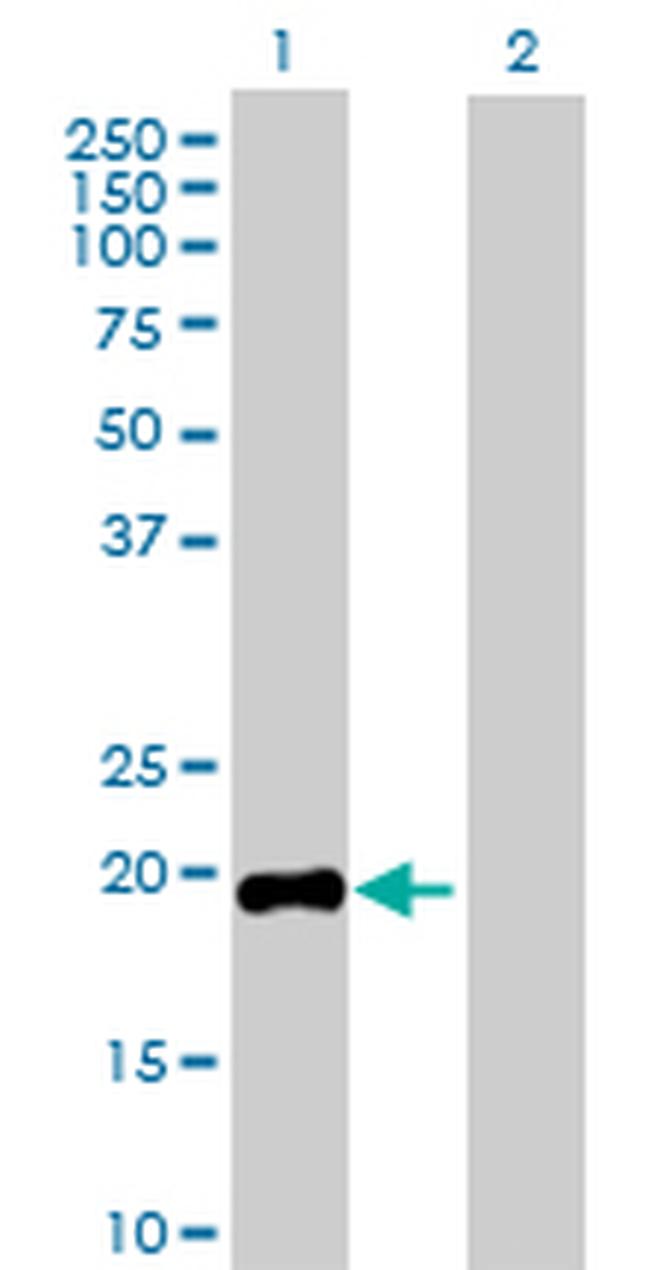 GH1 Antibody in Western Blot (WB)