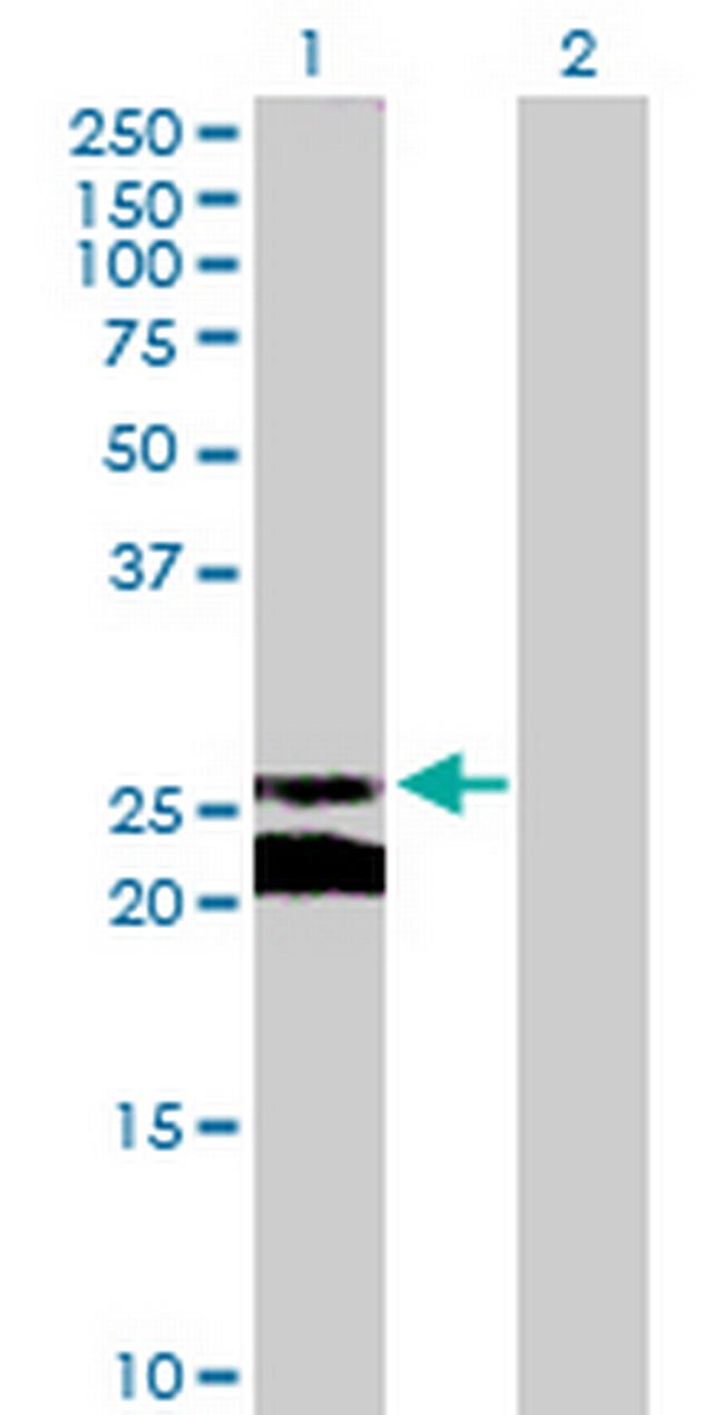 GJB5 Antibody in Western Blot (WB)