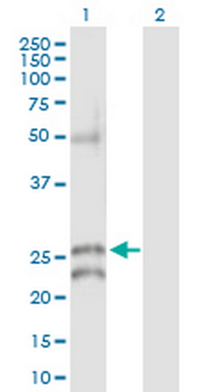 GJB5 Antibody in Western Blot (WB)