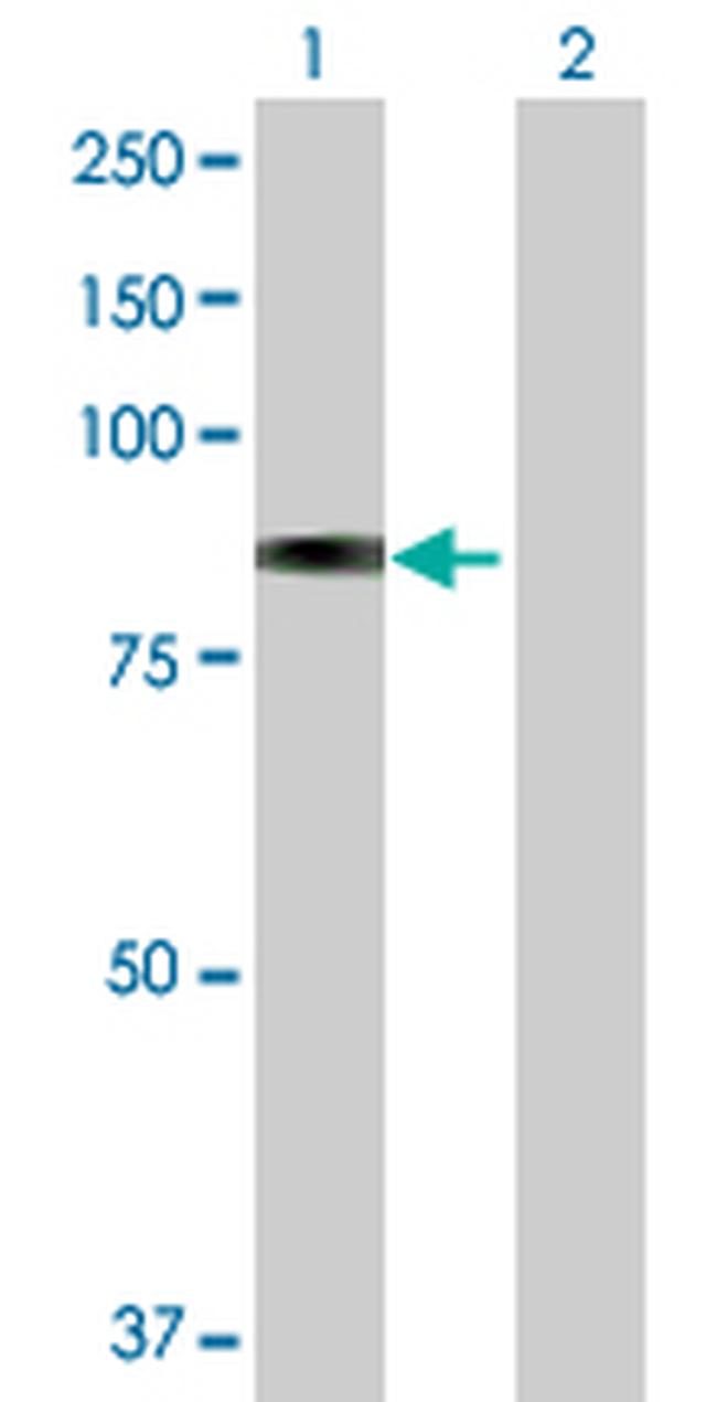 GLB1 Antibody in Western Blot (WB)