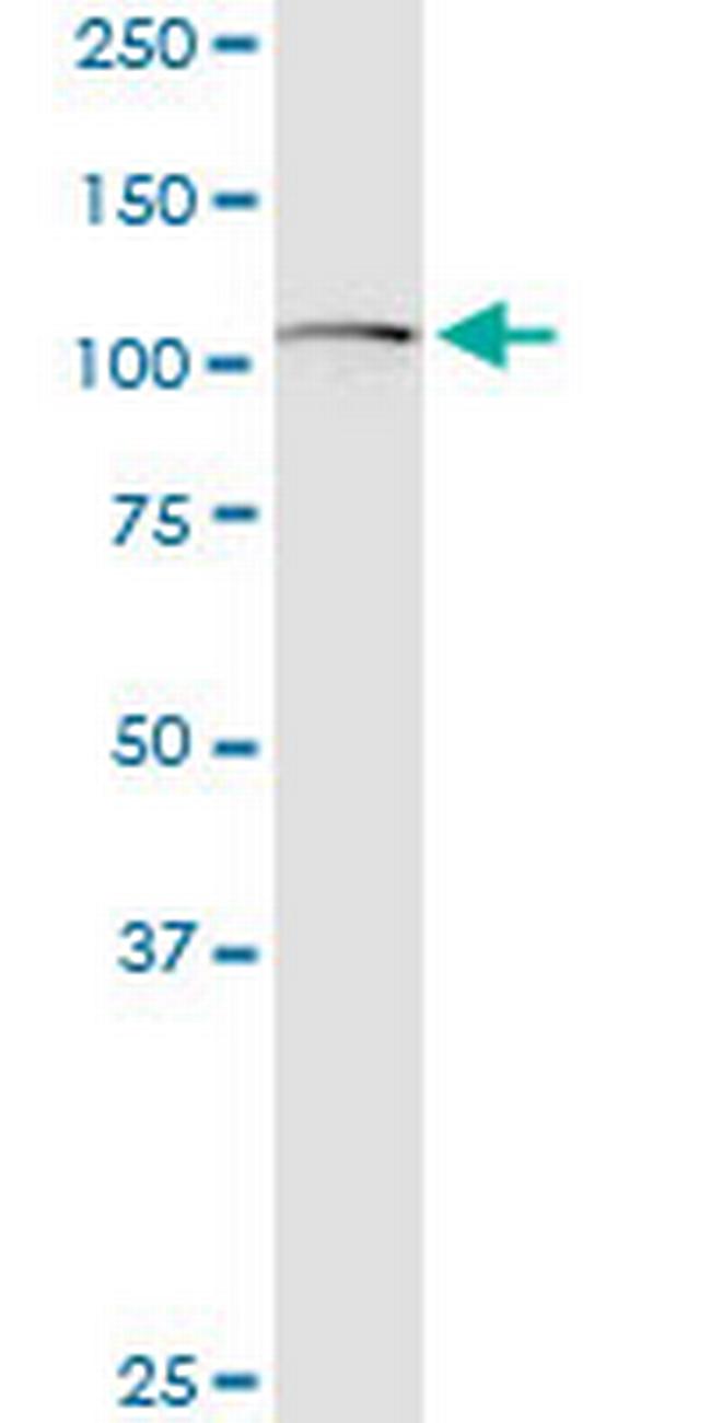 GLI1 Antibody in Western Blot (WB)