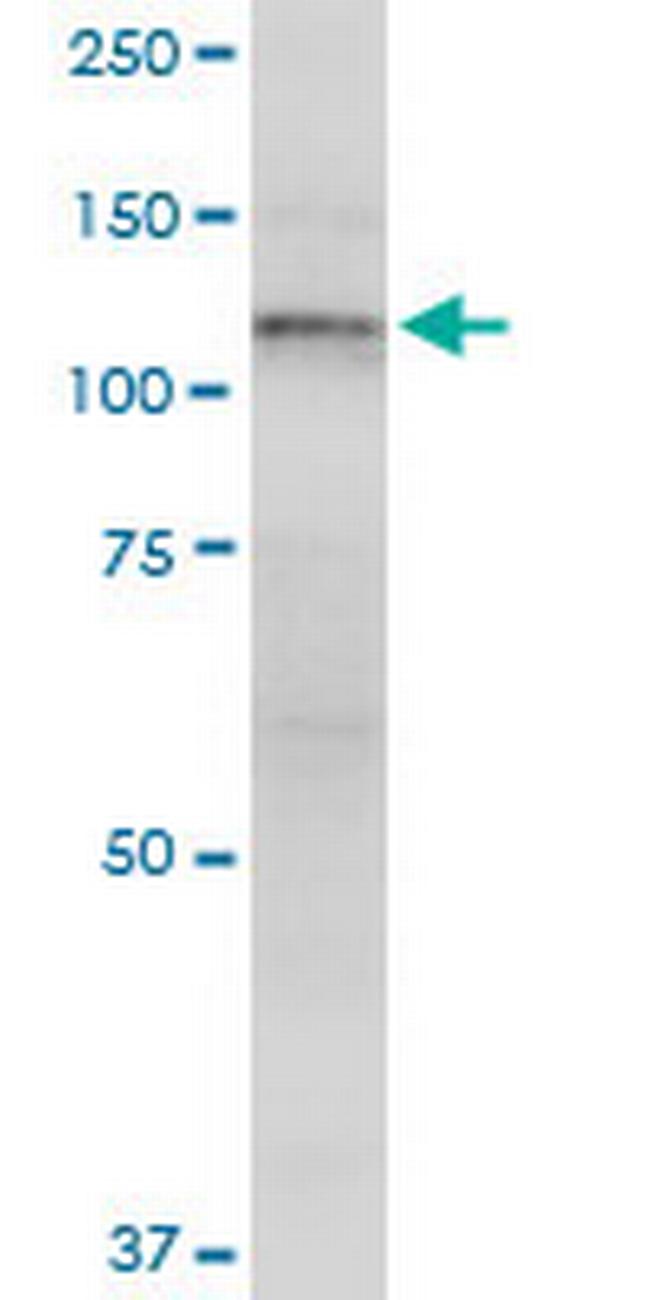 GLI1 Antibody in Western Blot (WB)