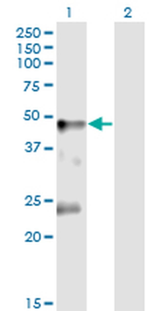 GLRA1 Antibody in Western Blot (WB)