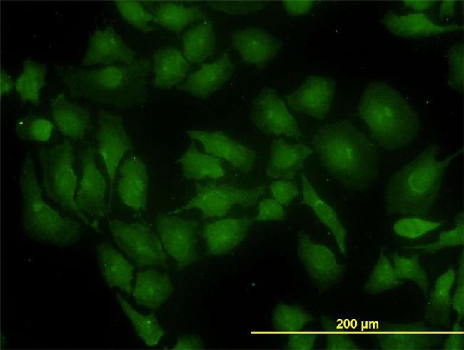 GLS Antibody in Immunocytochemistry (ICC/IF)