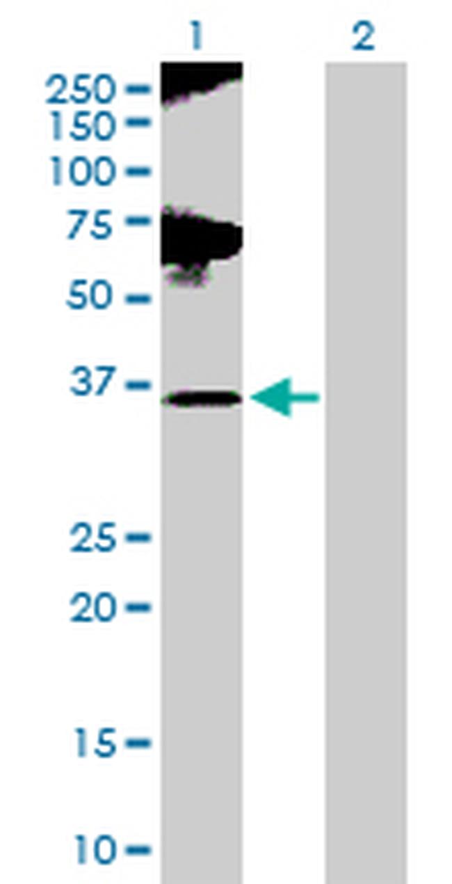 GLUL Antibody in Western Blot (WB)