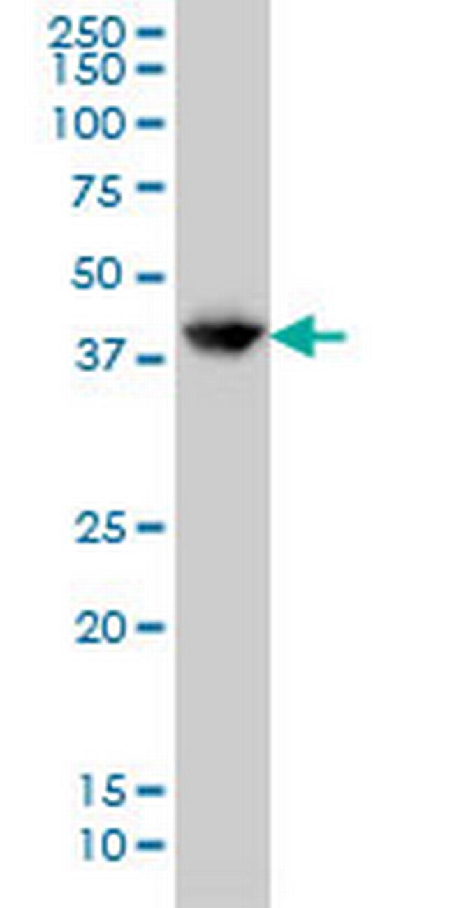 GLUL Antibody in Western Blot (WB)