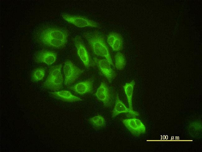 GMFB Antibody in Immunocytochemistry (ICC/IF)