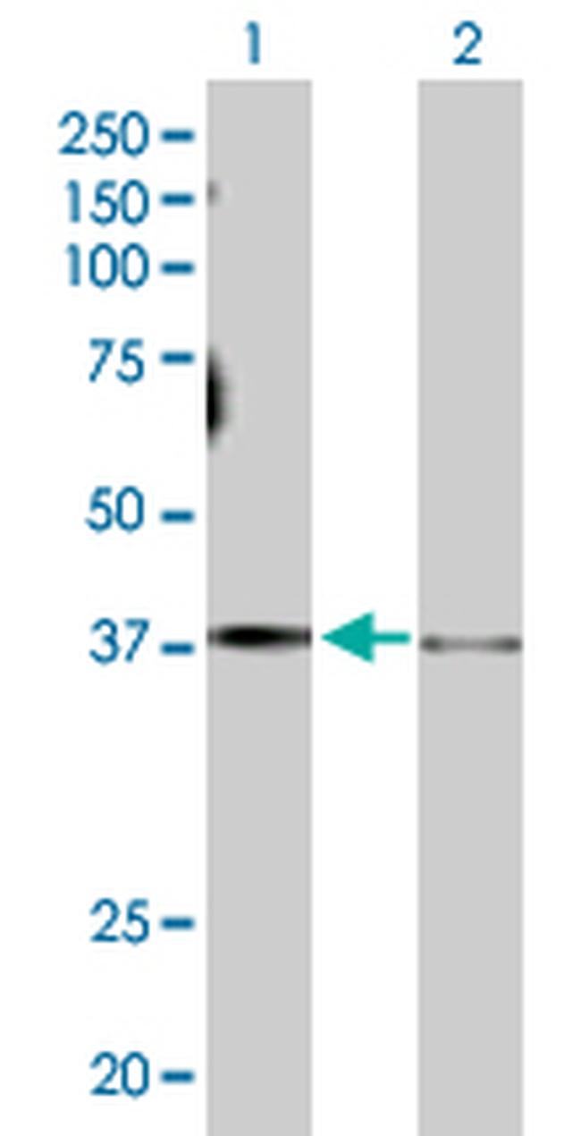 GNAS Antibody in Western Blot (WB)