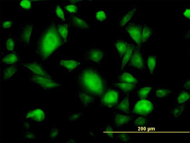 GNB3 Antibody in Immunocytochemistry (ICC/IF)