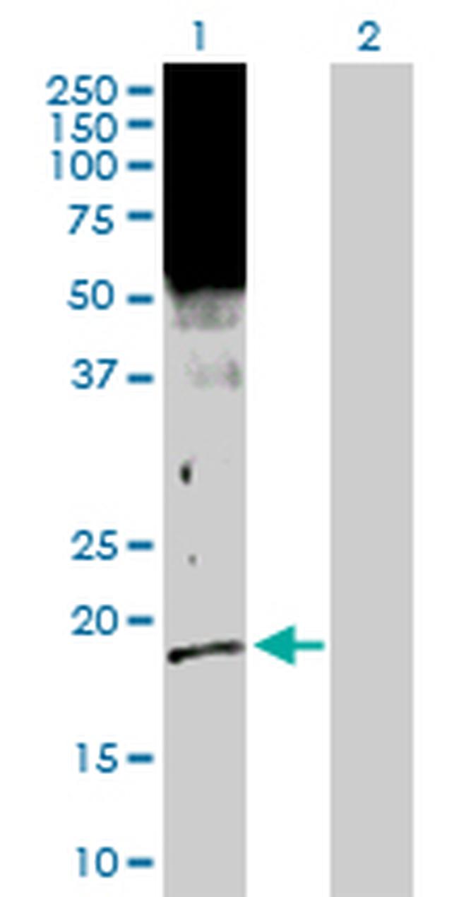 SFN Antibody in Western Blot (WB)