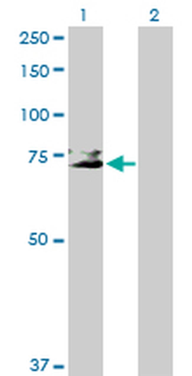 GP1BA Antibody in Western Blot (WB)