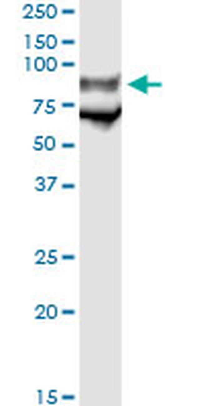 GP1BA Antibody in Immunoprecipitation (IP)