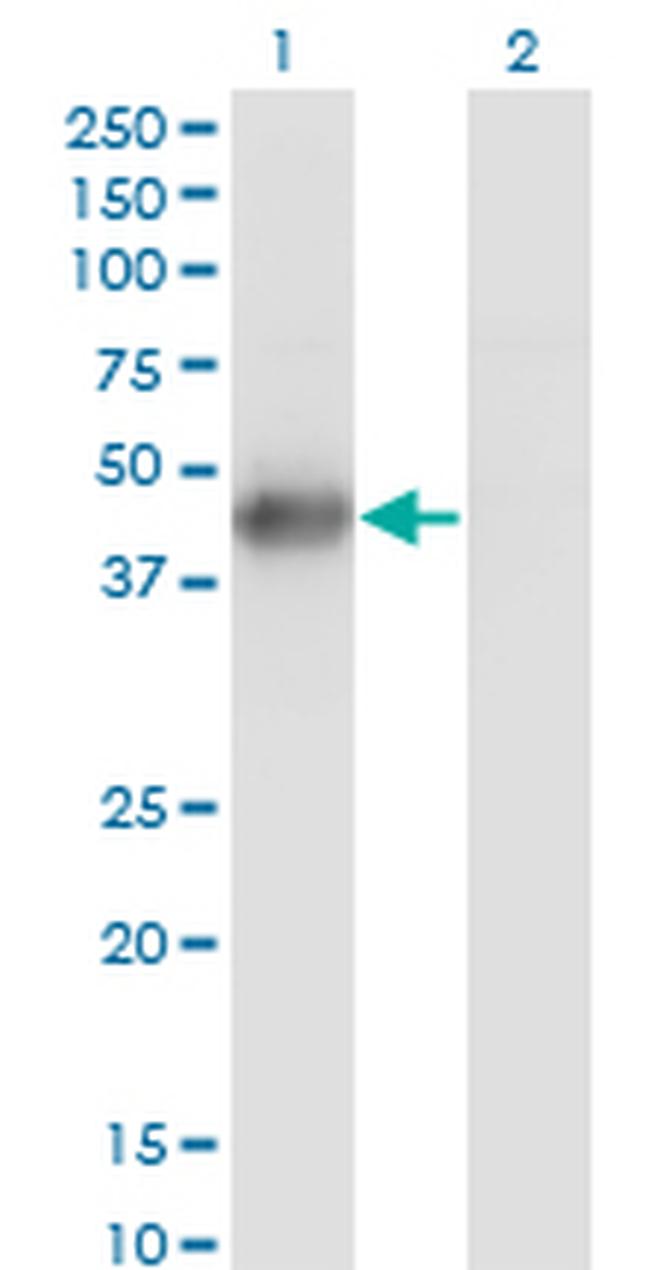 MKNK2 Antibody in Western Blot (WB)