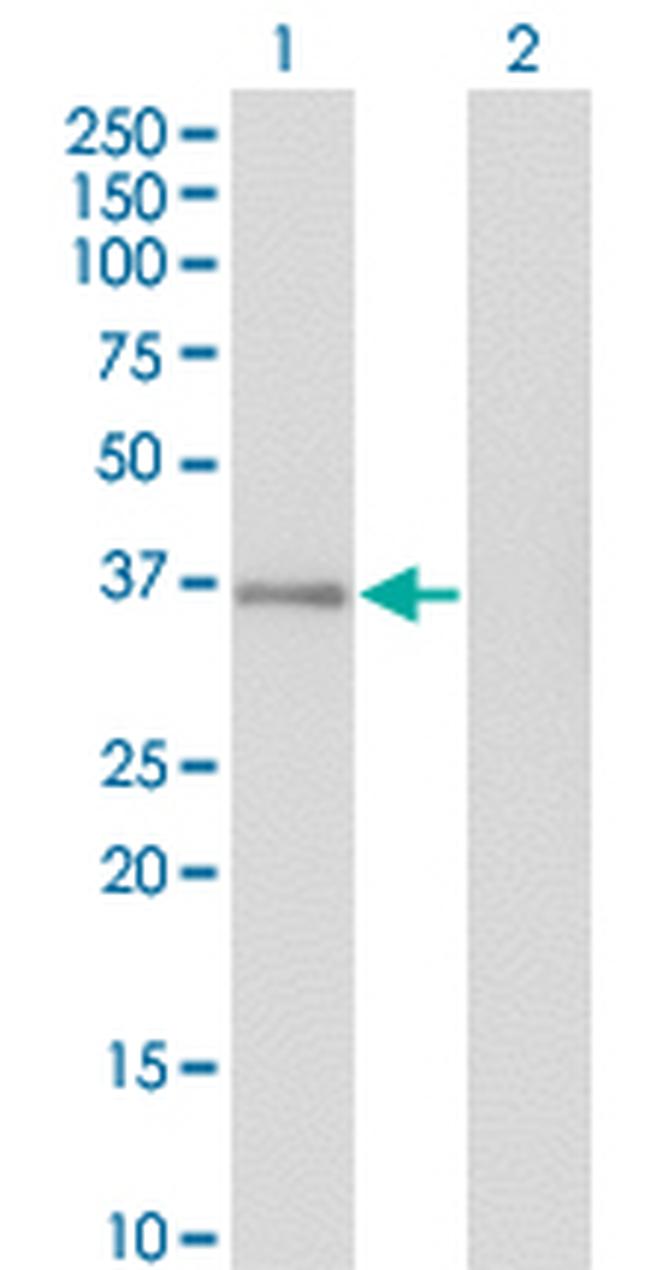 GPS2 Antibody in Western Blot (WB)