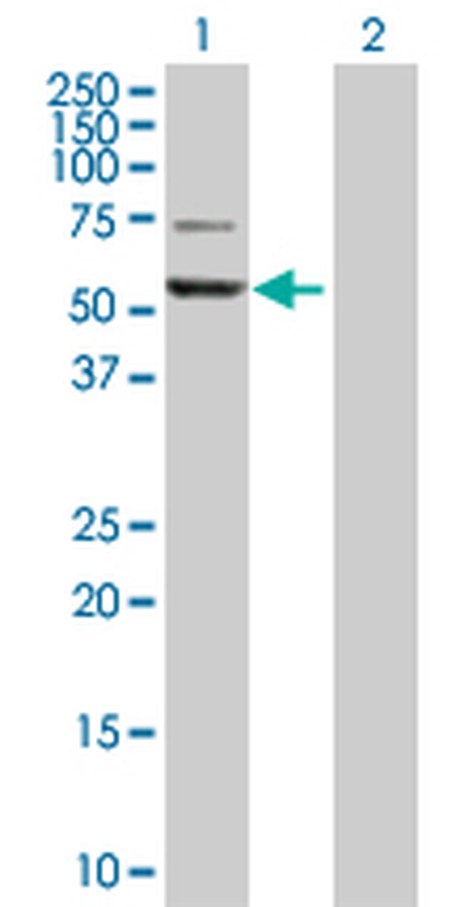 GPT Antibody in Western Blot (WB)