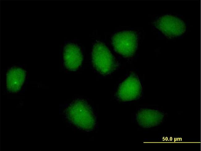 NR3C1 Antibody in Immunocytochemistry (ICC/IF)