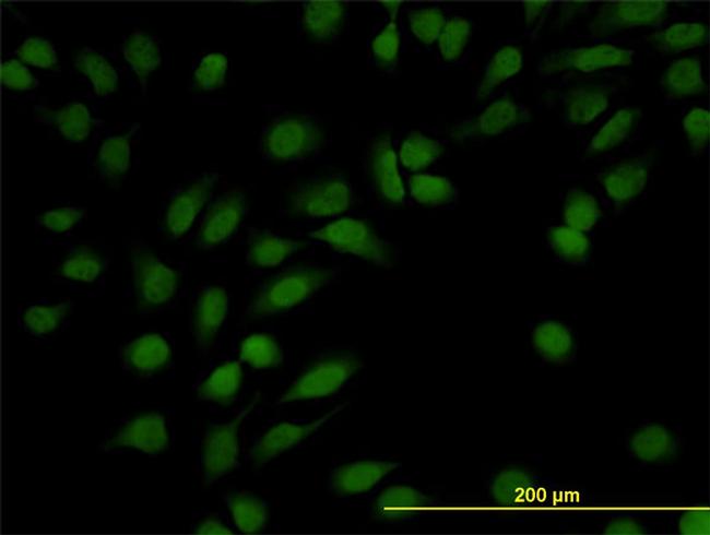 NR3C1 Antibody in Immunocytochemistry (ICC/IF)