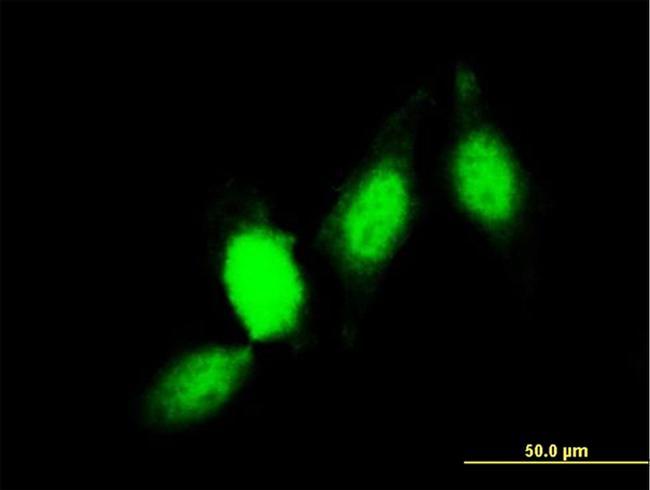 GSTP1 Antibody in Immunocytochemistry (ICC/IF)