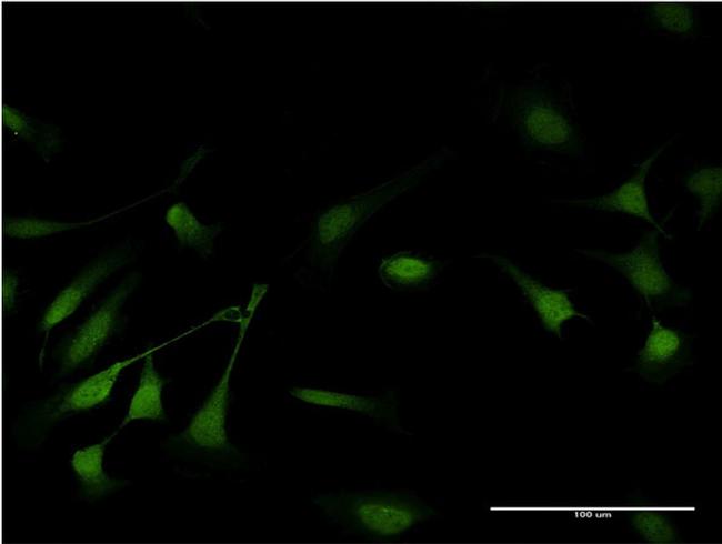 GSTP1 Antibody in Immunocytochemistry (ICC/IF)