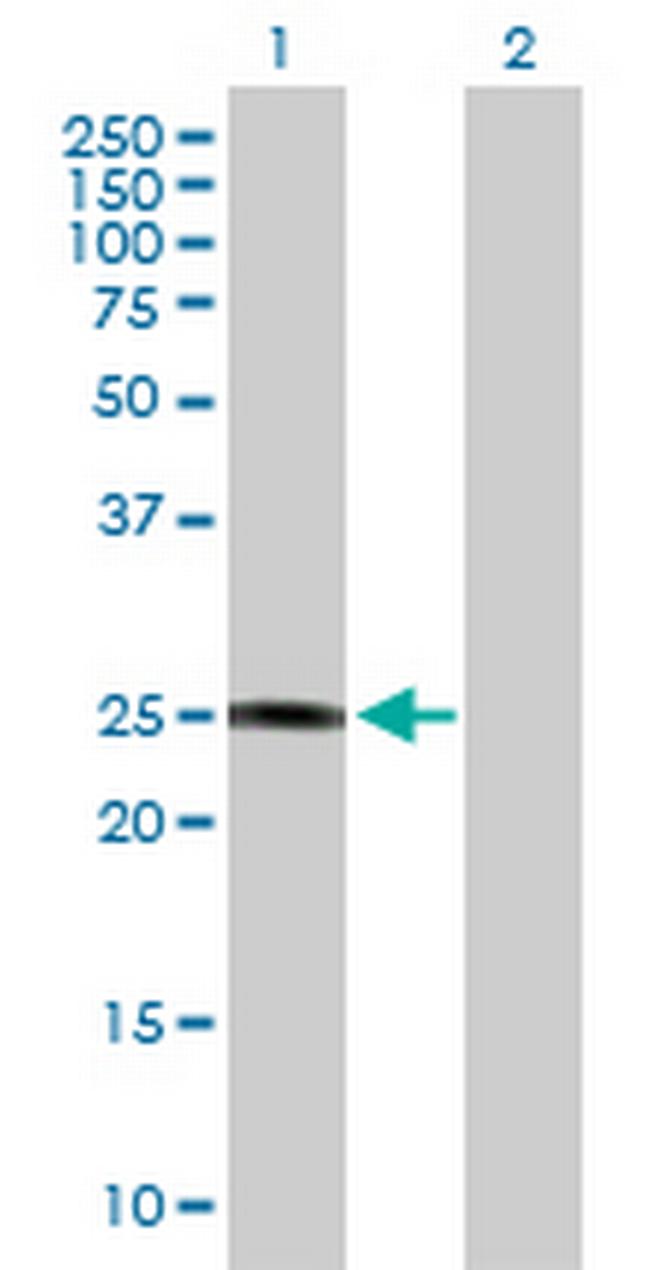 GSTZ1 Antibody in Western Blot (WB)