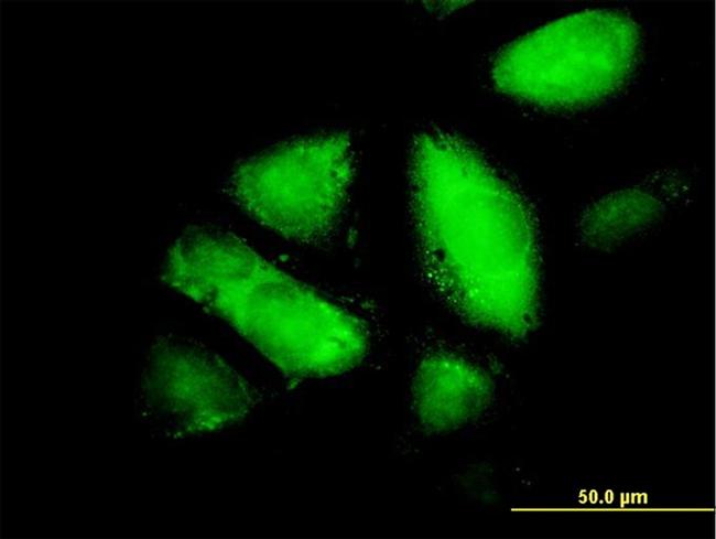 GSTZ1 Antibody in Immunocytochemistry (ICC/IF)