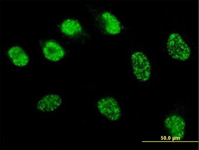 MSH6 Antibody in Immunocytochemistry (ICC/IF)