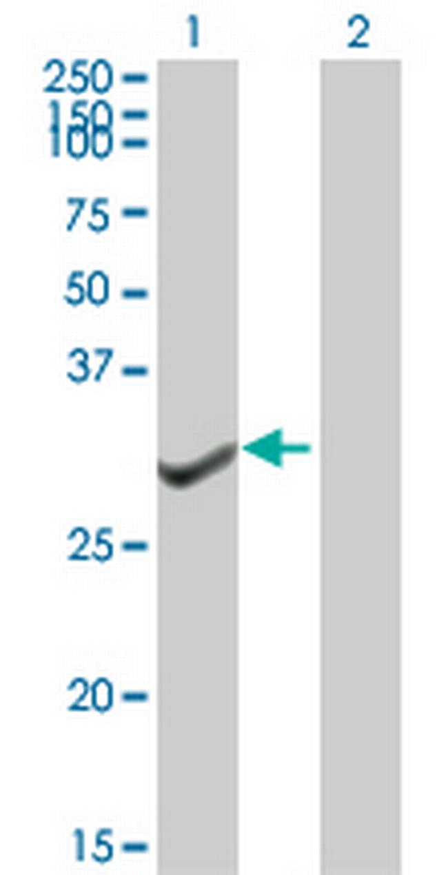 GTF2B Antibody in Western Blot (WB)