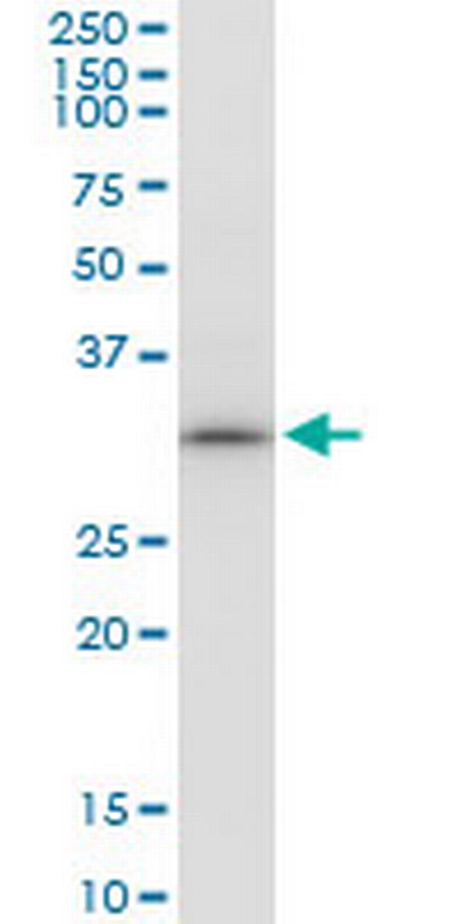 GTF2B Antibody in Western Blot (WB)