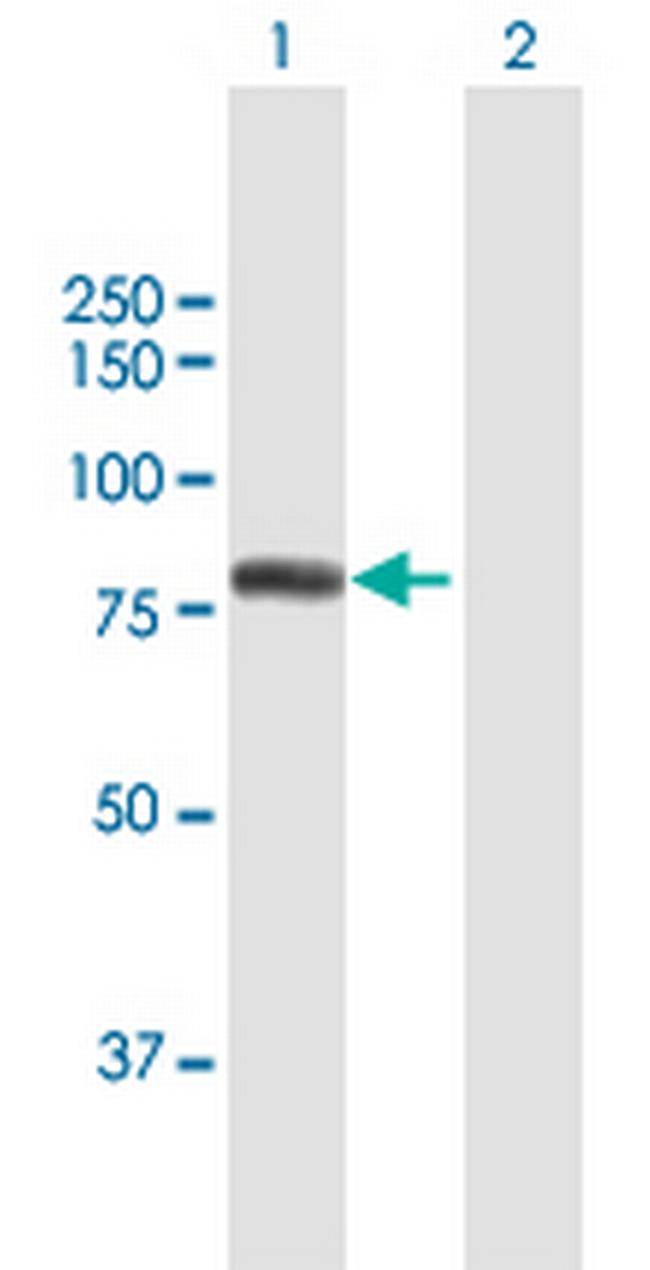 GTF2F1 Antibody in Western Blot (WB)