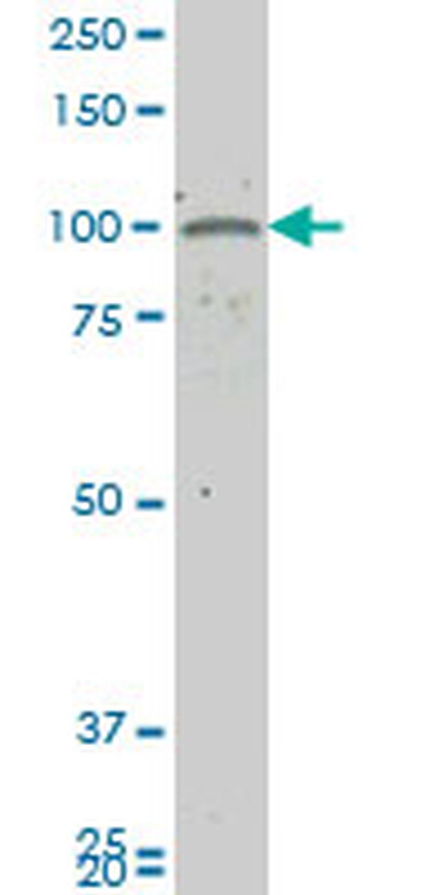 GUCY2C Antibody in Western Blot (WB)